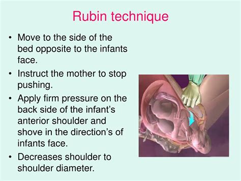 PPT - Dystocia caused by fetal anomalies PowerPoint Presentation, free ...