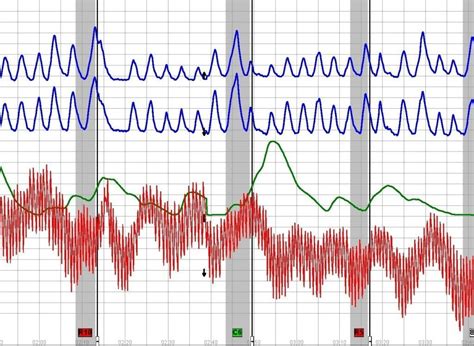 Image result for Polygraph Example