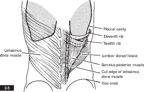 Image result for Flank Incision Nephrectomy