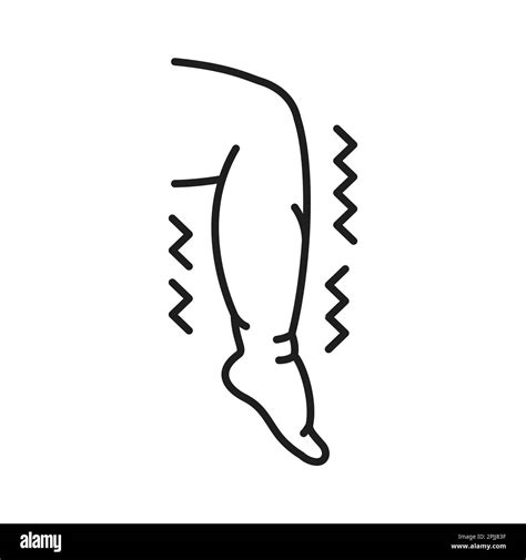 Leg Edema Medical Term at Jamie Gibb blog