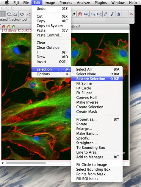 Fiji ImageJ Download 的图像结果