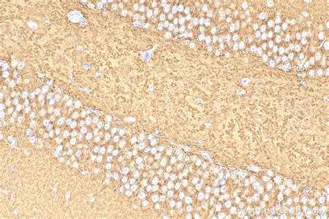 ATP6V1B1/2 antibody (15097-1-AP) | Proteintech