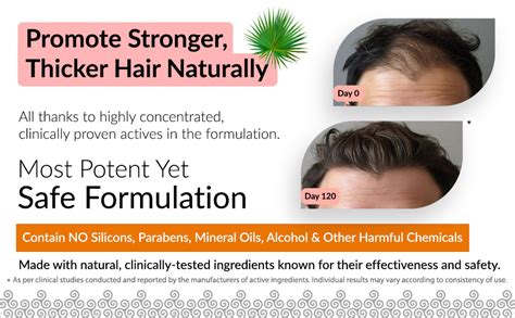 Buy Derma Global High Potency® Hair Growth Oil – Hair Defence Pro ...