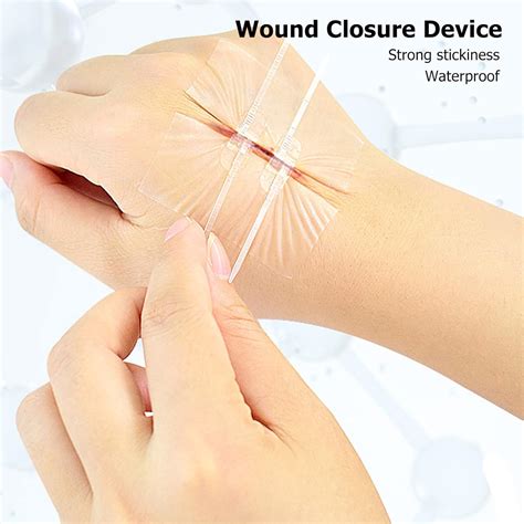 Buy Yosoo Secure Wound Closure with Zipper, Emergency Skin Adhesive ...