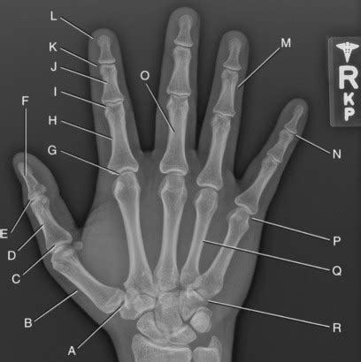 HAND ANATOMY Diagram | Quizlet