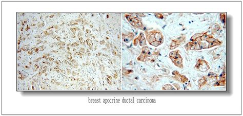 HER2/ErbB2 antibody (51105-1-AP) | Proteintech