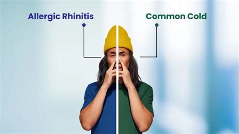 Allergic Rhinitis vs. Common Cold: How to Tell the Difference