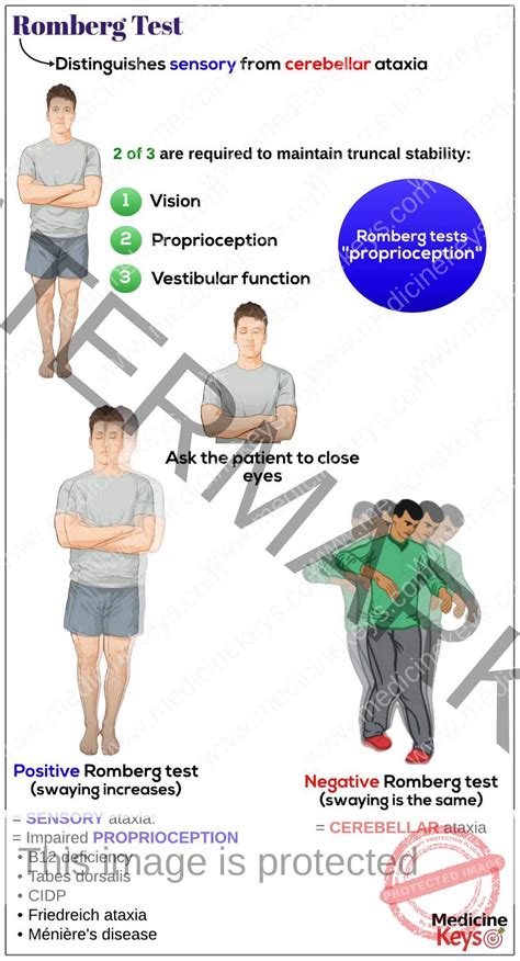 Teste De Romberg Como Fazer - BRAINCP