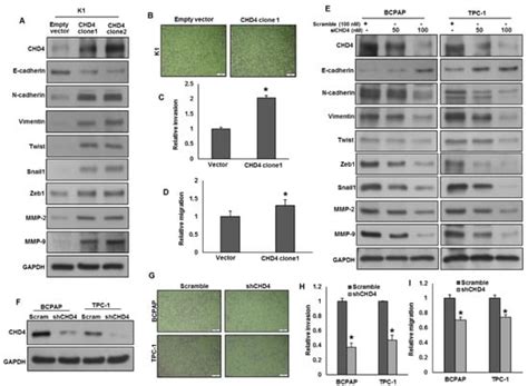 CHD4 Predicts Aggressiveness in PTC Patients and Promotes Cancer ...