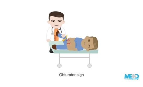 Image result for Psoas Sign Appendicitis