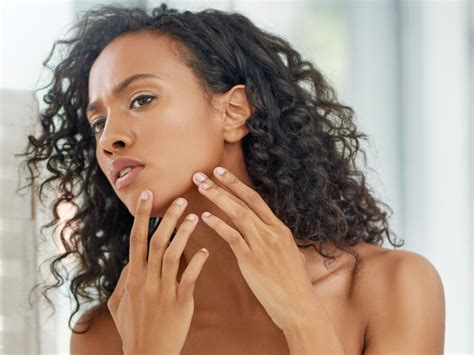 Ingrown Facial Hair Women