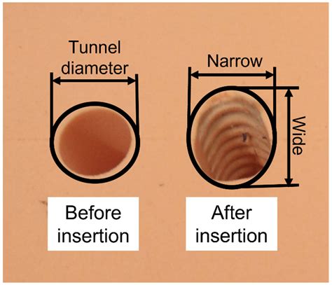 In Vitro Investigation of the Fixation Performance of a Bioabsorbable ...