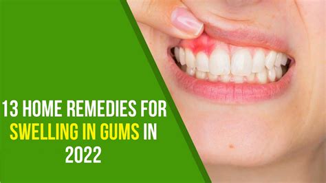 13 Amazing Home Remedies for Swelling in Gums in 2024