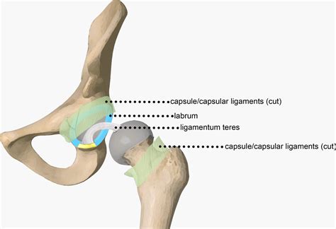 Hip Capsulolabral Complex: Anatomy, Disease, MRI Features, and ...
