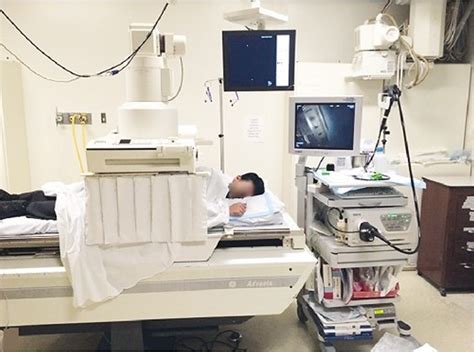 ercp 画像: ercp 画像所見 - PLNF