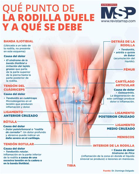 Anatomía Del Dolor De Rodilla Rodilla Del Corredor O Dolor Referido