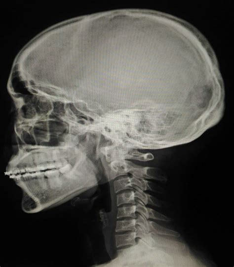 Bachelor’s Degree in Radiologic Technology - Radiology Technician