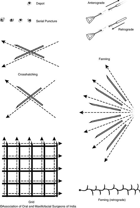 Image result for Injectable Pattern