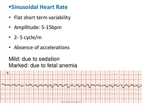 Cardiotocography: CTG antepartum and intrapartum