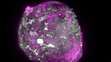 Human Embryo Models Made in Lab - The New York Times