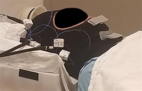 Novel AIR coil technology shows promise for whole-brain imaging