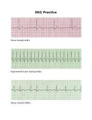 Image result for Synchronized Cardioversion EKG Strips Practice