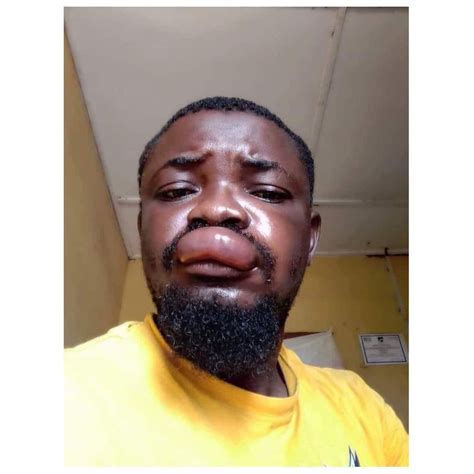 Mathematics teacher reportedly st¥ng by a bee while preparing his students for an exam There was ...