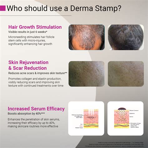 Derma Stamp | Adjustable Titanium Coated Needles - 0.25mm to 3mm