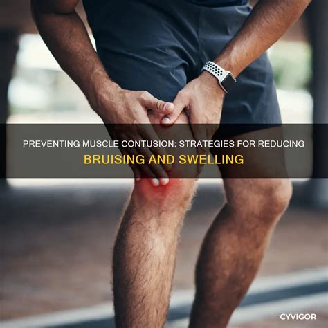 Preventing Muscle Contusion: Strategies For Reducing Bruising And Swelling | CyVigor