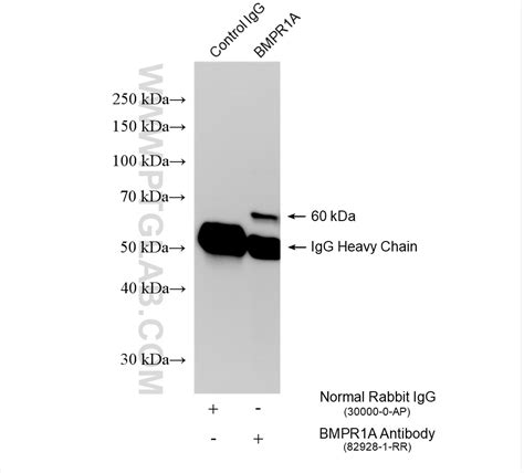 BMPR1A antibody (82928-1-PBS) | Proteintech