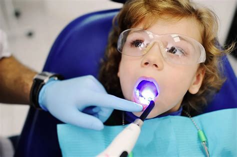 Sealing teeth: Procedure, costs, advantages and disadvantages | CURAPROX