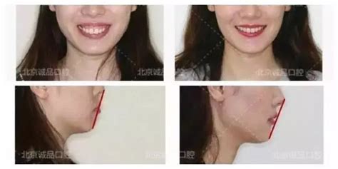 中年妇女微笑尖嘴完美牙齿概念白牙高清图片下载-正版图片505495017-摄图网