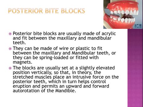 Management of Open Bite | PPTX