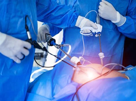 Laparoscopic surgery in Kerala - Best laparoscopic surgeon Near Kochi