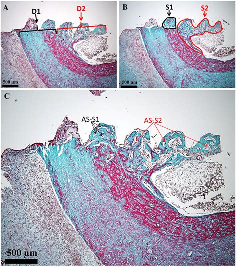 Participation of the Periosteum, Endosteum, and Hematogenous Marrow in ...
