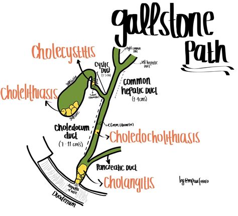Cholangitis Vs Cholecystitis Cholecystitis Vs Choledocholithiasis Vs