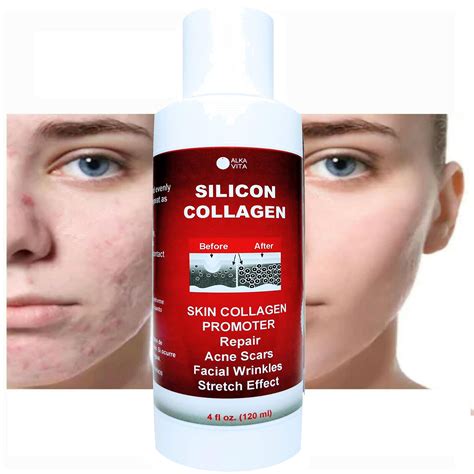 Skin Scars Silicon And Collagen Hydrolyzed Gel Resurfacing Skin ...