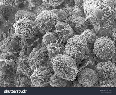 Scanning Electron Microscope Cell 的图像结果