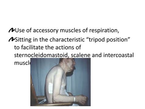 PPT - UNIT III:Chronic Obstructive Pulmonary Disease(COPD) PowerPoint ...