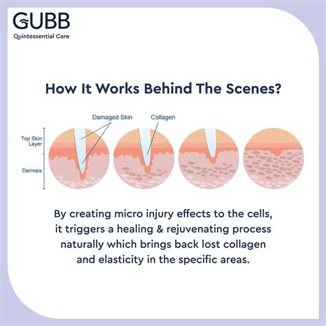 Buy GUBB DERMA ROLLER 0.5MM FOR HAIR REGROWTH FACE ACNE SCARS & SKIN ...