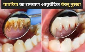 दांतों का पायरिया कैसे ठीक करें? Dr. Deepak Kumar ने बताया दांत की सभी ...