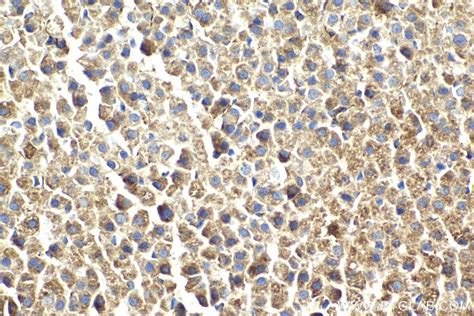 LETM1 antibody (68208-1-Ig) | Proteintech