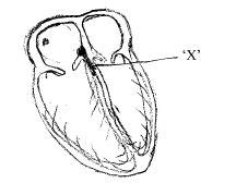 In the given diagram, the role of 'X' is to - Tardigrade
