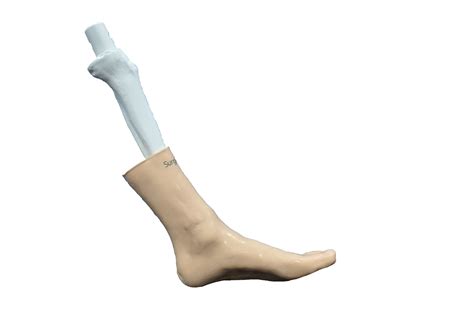 Weber B Fracture – SurgiSTUD