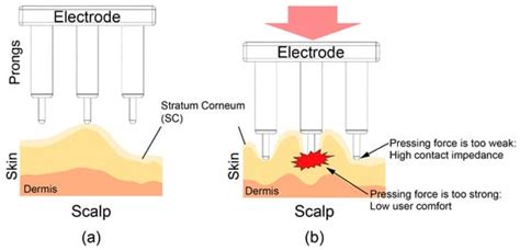 3D Printable Dry EEG Electrodes with Coiled-Spring Prongs