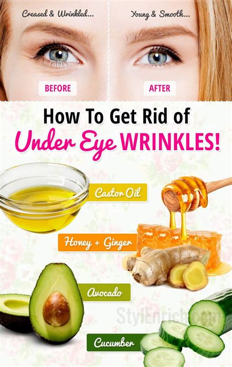 How to Get Rid of Under Eye Wrinkles or Under Eye Creases! https ...