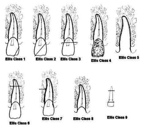Image result for Graphical Abstract Examples of a Process
