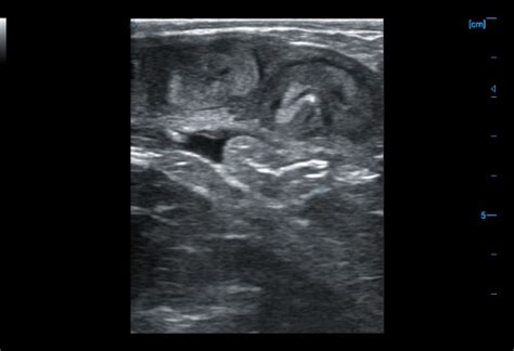 Image result for How Does Ultrasound Work