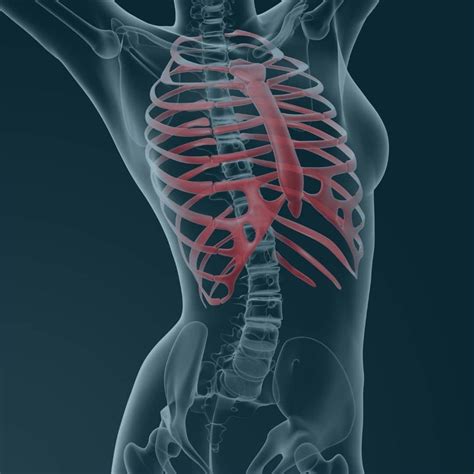 What are the Causes and Support for Flared Ribs | Kim Prichard | Chichester