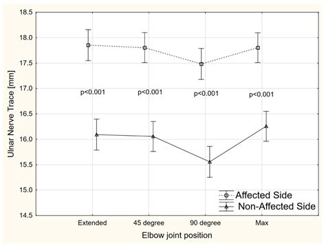 Changes in Ultrasound Measurements of the Ulnar Nerve at Different ...
